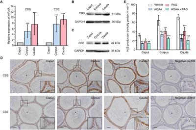 Cellular Mechanism Underlying Hydrogen Sulfide Mediated Epithelial K+ Secretion in Rat Epididymis